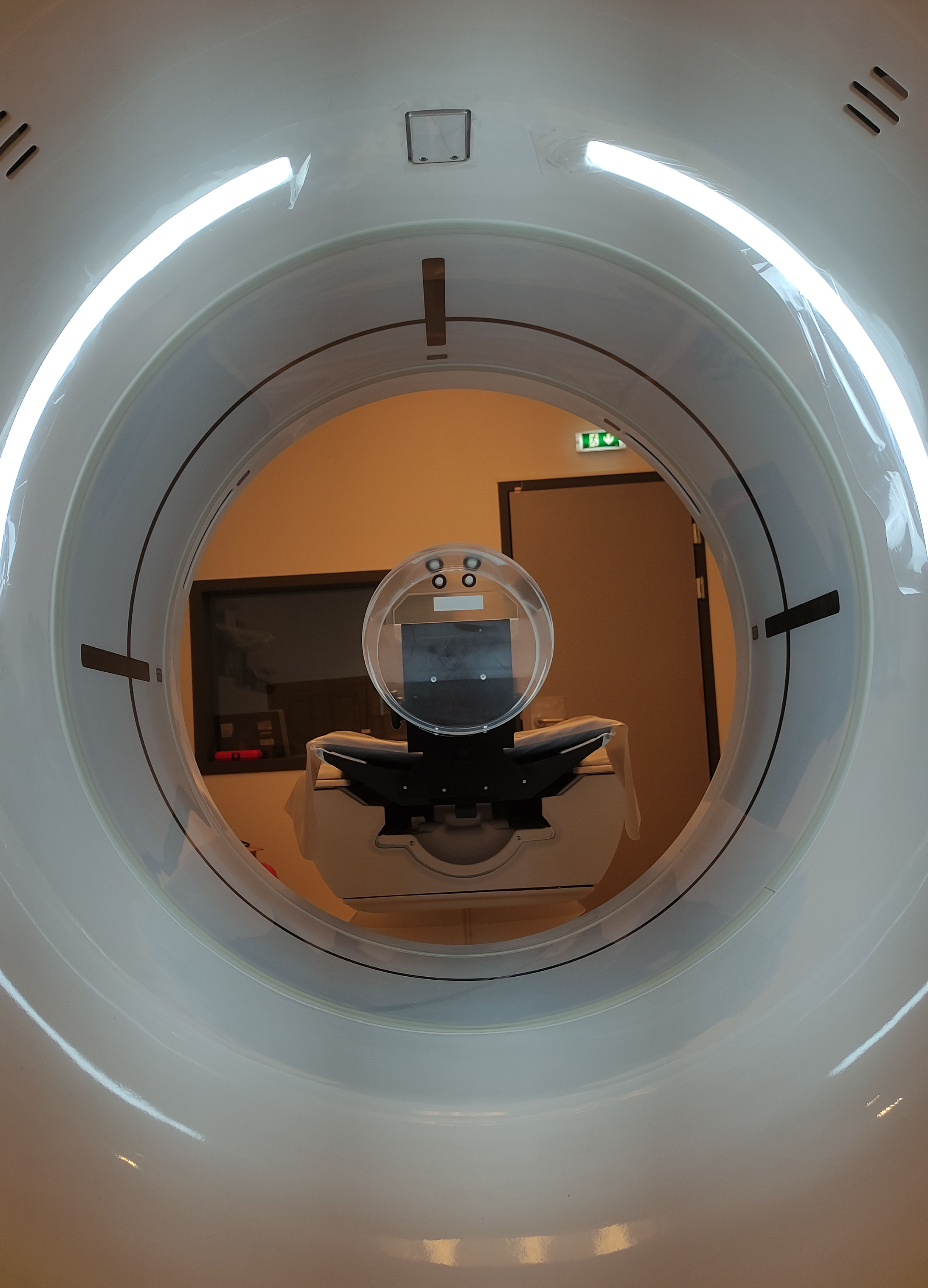 CT Scan Revolution